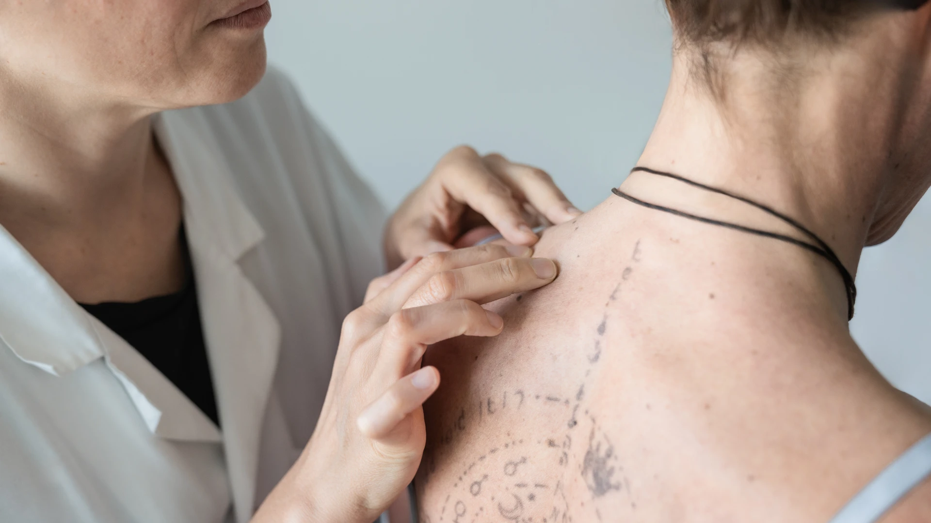 Diagnosi dell'artrite psoriasica Diagnosi dell'artrite psoriasica