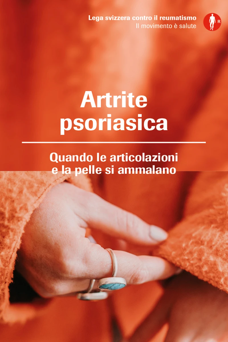 Nuovo opuscolo sull'artrite psoriasica Nuovo opuscolo sull'artrite psoriasica